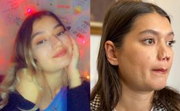 ‘Burnum çöktü’ dedi, 1 milyon liralık dava açtı