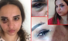 Bir yıldır boşanmak istediği eşi Leyla’yı bu hale getirdi